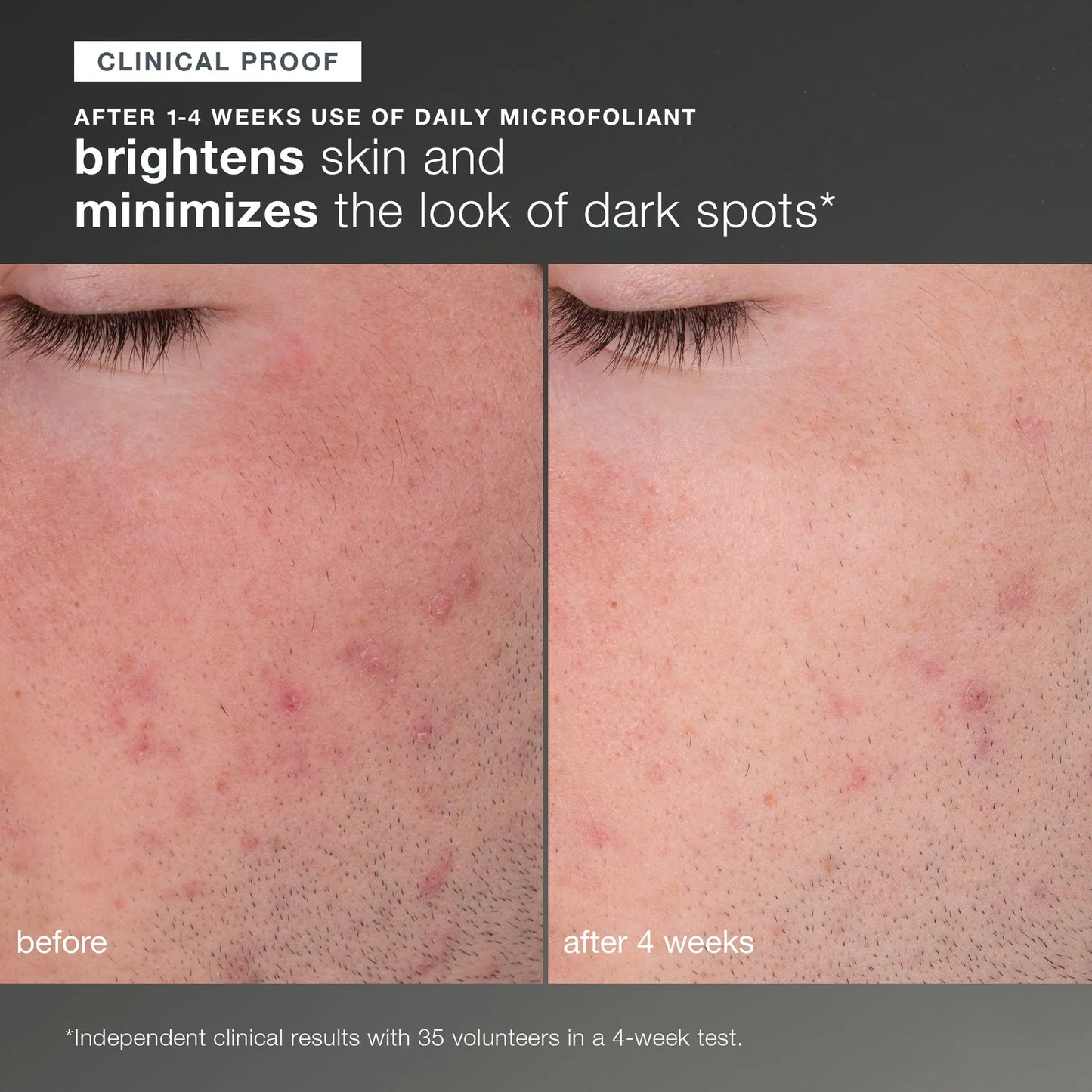 ⚡ Discover Healthy Skin Kit